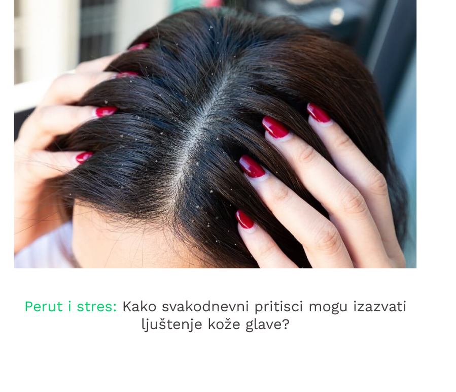Perut i stres kako svakodnevni pritisci mogu izazvati ljustenje koze glave